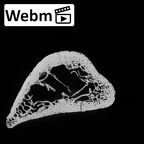 DV14-104 Homo sapiens humerus right distal ct stack movie