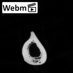 DV14-109 Homo sapiens radius right ct stack movie