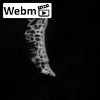 DV14-110 Homo sapiens radius right distal ct stack movie