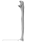 DV15-100 Homo sapiens ulna right medial