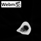 DV15-100 Homo sapiens ulna right ct stack movie