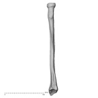 DV15-102 H. sapiens radius right