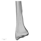 DV15-102 Homo sapiens radius right distal anterior
