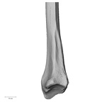 DV15-102 Homo sapiens radius right distal medial