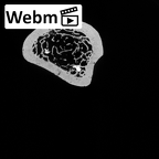 DV15-102 Homo sapiens radius right distal ct stack movie