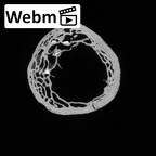 DV15-103 Homo sapiens radius left proximal ct stack movie