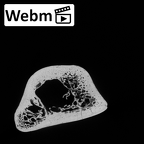 DV15-98 Homo sapiens humerus right distal ct stack movie