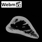 DV16-60 Homo sapiens humerus left distal ct stack movie
