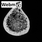 DV16-61 Homo sapiens ulna right distal ct stack movie