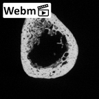 DV16-62 Homo sapiens ulna left distal ct stack movie