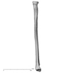 DV16-64 Homo sapiens radius left medial