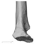 DV16-64 H. sapiens radius left distal