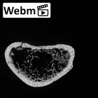 DV16-64 Homo sapiens radius left distal ct stack movie