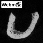 DV50 Homo sapiens radius left ct stack movie