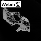 Pav1-1 Homo sapiens temporal left ct stack movie