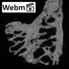 Pav1-40 Homo sapiens vertebra ct stack movie