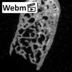 Pav1-41 Homo sapiens vertebra ct stack movie