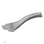 Pav1-44 Homo sapiens clavicle left superior
