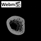 Pav1-44 Homo sapiens clavicle left ct stack movie