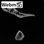 Pav1-45 Homo sapiens scapula right ct stack movie