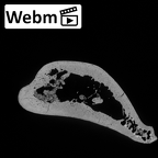 Pav1-47 Homo sapiens humerus left distal ct stack movie