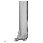 Pav1-48 Homo sapiens humerus right distal medial