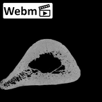 Pav1-48 Homo sapiens humerus right distal ct stack movie