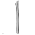 Pav1-52 Homo sapiens radius left anterior