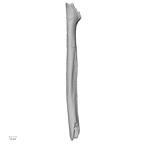 Pav1-52 Homo sapiens radius left posterior