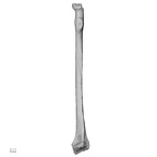 Pav1-53 H. sapiens radius right