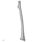 Pav1-53 Homo sapiens radius right posterior