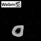 Pav1-53 Homo sapiens radius right ct stack movie
