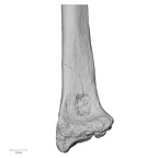 Pav1-53 Homo sapiens radius right distal anterior