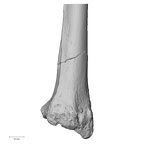 Pav1-53 Homo sapiens radius right distal posterior