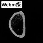 Pav1-53 Homo sapiens radius right distal ct stack movie