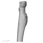 Pav1-53 Homo sapiens radius right proximal posterior