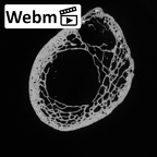 Pav1-53 Homo sapiens radius right proximal ct stack movie