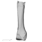 Pav1-54 Homo sapiens metacarpal third left dorsal