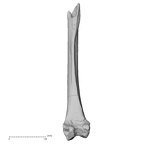 Pav1-55 Homo sapiens femur right posterior