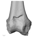 Pav1-55 Homo sapiens femur right distal anterior