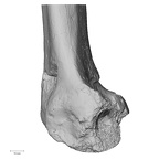 Pav1-55 Homo sapiens femur right distal medial