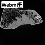 Pav1-55 Homo sapiens femur right distal ct stack movie
