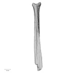 Pav1-59 Homo sapiens fibula left anterior