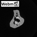 Pav1-59 Homo sapiens fibula left ct stack movie