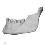Pav1-5 Homo sapiens mandible lateral