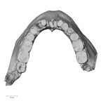 Pav1-5 H. sapiens mandible dentition