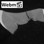 Pav10-1 Homo sapiens LRDM2 ct stack movie