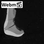 Pav11-1 Homo sapiens URDM1 ct stack movie