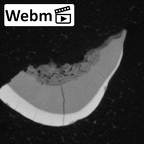 Pav11-1 Homo sapiens URDM1 ct stack movie