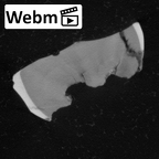 Pav12-1 Homo sapiens URDM2 ct stack movie
